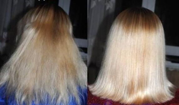 Before and after restoration of hair